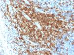 CD43 Antibody in Immunohistochemistry (Paraffin) (IHC (P))