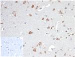 Osteopontin (OSP)/Secreted Phosphoprotein 1 (SPP1) Antibody in Immunohistochemistry (Paraffin) (IHC (P))