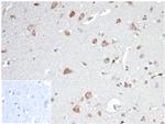 Osteopontin (OSP)/Secreted Phosphoprotein 1 (SPP1) Antibody in Immunohistochemistry (Paraffin) (IHC (P))