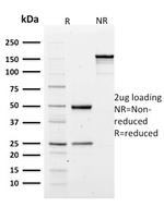 Spectrin Alpha 1 Antibody in SDS-PAGE (SDS-PAGE)