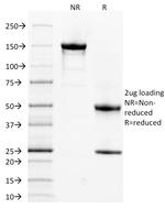 Spectrin Alpha 1 Antibody in SDS-PAGE (SDS-PAGE)