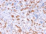 Spectrin Alpha 1 (Erythrocyte Marker) Antibody in Immunohistochemistry (Paraffin) (IHC (P))