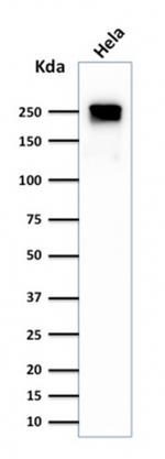 Spectrin beta III (SPTBN2) Antibody in Western Blot (WB)