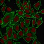 Spectrin beta III (SPTBN2) Antibody in Immunocytochemistry (ICC/IF)