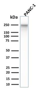 Spectrin beta III (SPTBN2) Antibody in Western Blot (WB)