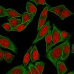 Spectrin beta III (SPTBN2) Antibody in Immunocytochemistry (ICC/IF)