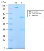 Spectrin beta III (SPTBN2) Antibody in SDS-PAGE (SDS-PAGE)