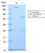 Spectrin beta III (SPTBN2) Antibody in SDS-PAGE (SDS-PAGE)