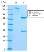 Spectrin beta III (SPTBN2) Antibody in SDS-PAGE (SDS-PAGE)