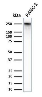 Spectrin beta III (SPTBN2) Antibody in Western Blot (WB)