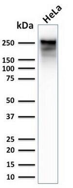 Spectrin beta III (SPTBN2) Antibody in Western Blot (WB)