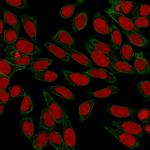 Spectrin beta III (SPTBN2) Antibody in Immunocytochemistry (ICC/IF)