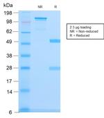 Spectrin beta III (SPTBN2) Antibody in SDS-PAGE (SDS-PAGE)