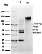 Serum Response Element Binding Transcription Factor (SRF) Antibody in SDS-PAGE (SDS-PAGE)