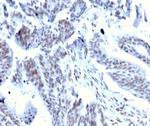 Serum Response Element Binding Transcription Factor (SRF) Antibody in Immunohistochemistry (Paraffin) (IHC (P))