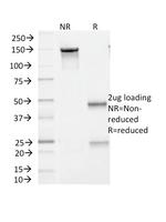 BRAF (V600E Mutant Specific) (Prognostic Marker) Antibody in SDS-PAGE (SDS-PAGE)