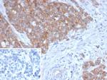 BRAF Antibody in Immunohistochemistry (Paraffin) (IHC (P))