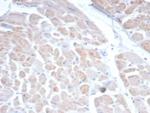 SSTR2 Antibody in Immunohistochemistry (Paraffin) (IHC (P))