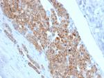 StAR (Steroidogenic Acute Regulator) Antibody in Immunohistochemistry (Paraffin) (IHC (P))