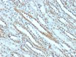 STAT3/Signal Transducer and Activator of Transcription 3 Antibody in Immunohistochemistry (Paraffin) (IHC (P))