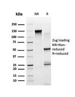 STAT5A Antibody in SDS-PAGE (SDS-PAGE)