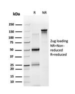 STAT5A Antibody in SDS-PAGE (SDS-PAGE)