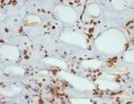 STAT6 (Solitary Fibrous Tumor Marker) Antibody in Immunohistochemistry (Paraffin) (IHC (P))