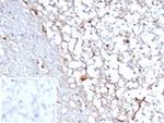 STAT6 (Solitary Fibrous Tumor Marker) Antibody in Immunohistochemistry (Paraffin) (IHC (P))