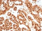 STAT6 (Solitary Fibrous Tumor Marker) Antibody in Immunohistochemistry (Paraffin) (IHC (P))