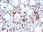 STAT6 (Solitary Fibrous Tumor Marker) Antibody in Immunohistochemistry (Paraffin) (IHC (P))