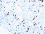 STAT6 (Solitary Fibrous Tumor Marker) Antibody in Immunohistochemistry (Paraffin) (IHC (P))