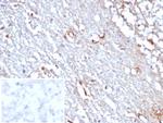 STAT6 (Solitary Fibrous Tumor Marker) Antibody in Immunohistochemistry (Paraffin) (IHC (P))