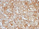 CD147/EMMPRIN/Neurothelin Antibody in Immunohistochemistry (Paraffin) (IHC (P))