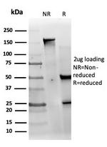 MED22 (Transcription Factor) Antibody in SDS-PAGE (SDS-PAGE)