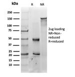 MED22 (Transcription Factor) Antibody in SDS-PAGE (SDS-PAGE)