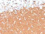 Synaptophysin Antibody in Immunohistochemistry (Paraffin) (IHC (P))