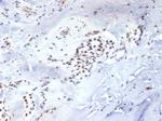 TBXT/T-box transcription factor T/Brachyury Antibody in Immunohistochemistry (Paraffin) (IHC (P))