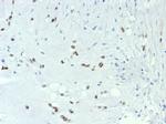 TBXT/T-box transcription factor T/Brachyury Antibody in Immunohistochemistry (Paraffin) (IHC (P))