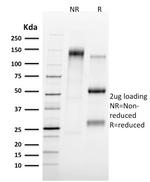 Tal1 Antibody in SDS-PAGE (SDS-PAGE)