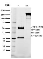 Tal1 Antibody in SDS-PAGE (SDS-PAGE)