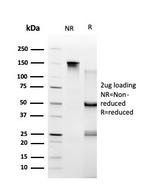 TRBP2/TARBP2 Antibody in SDS-PAGE (SDS-PAGE)