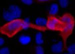 6x-His Tag Antibody in Immunocytochemistry (ICC/IF)