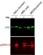 Phospho-ERK1/ERK2 (Thr185, Tyr187) Antibody