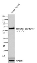 Phospho-SMAD1/SMAD5 (Ser463, Ser465) Antibody in Western Blot (WB)