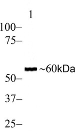 SMAD2 Antibody in Western Blot (WB)