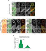 Vinculin Antibody in Immunohistochemistry (IHC)