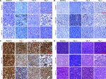 Caspase 3 Antibody in Immunohistochemistry (Paraffin) (IHC (P))