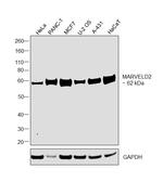 MARVELD2 Antibody in Western Blot (WB)