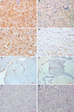 Phospho-FAK (Tyr397) Antibody in Immunohistochemistry (Paraffin) (IHC (P))