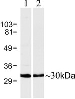 Connexin 30 Antibody in Western Blot (WB)